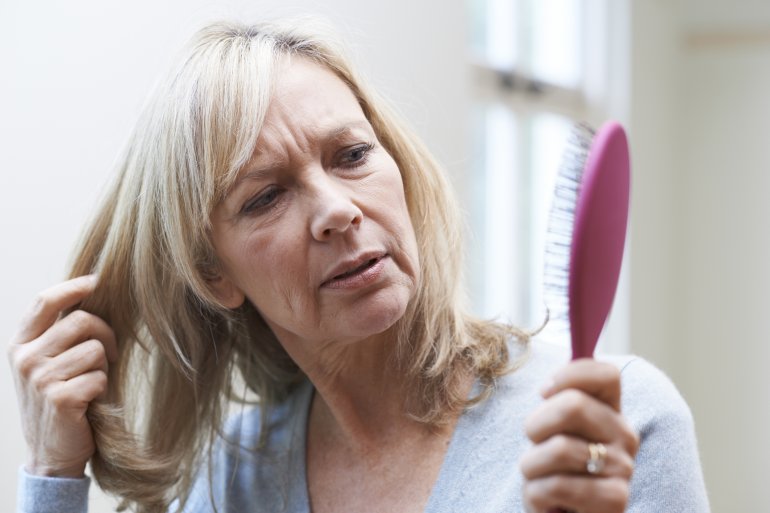 Frau mit Haarausfall