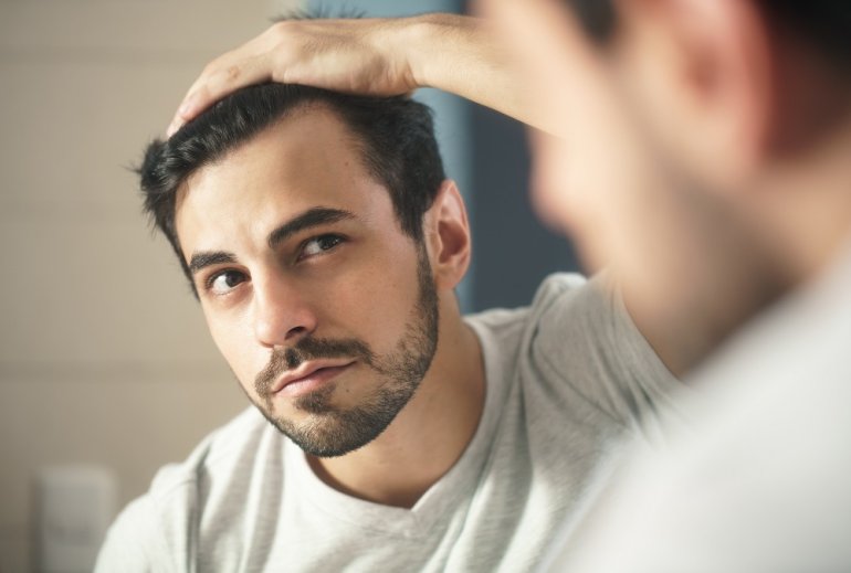 Mann mit Haarausfall