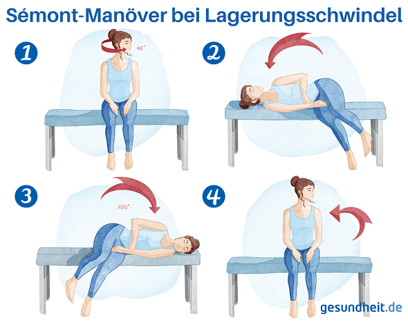 Sémont-Manöver bei Lagerungsschwindel (Infografik)