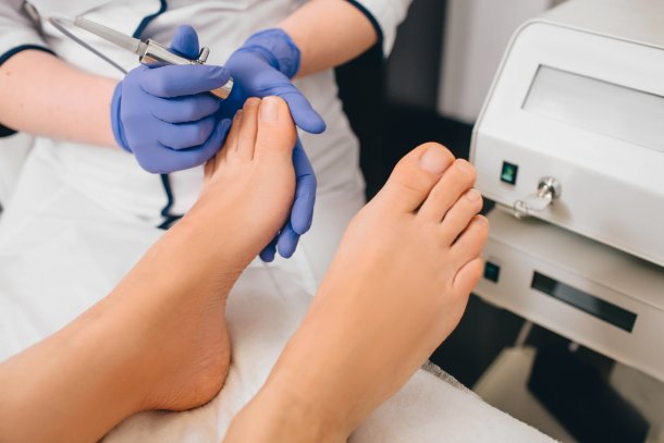 Lichttherapie gegen Nagelpilz