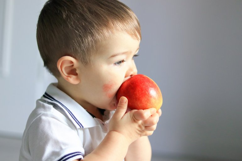 Ernährung bei Neurodermitis