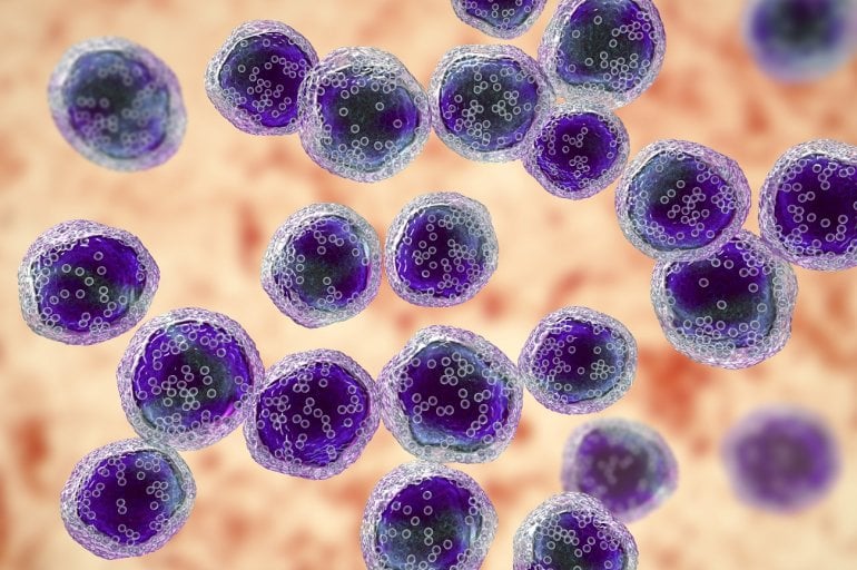 B-Zell-Lymphozyten beim Non-Hodgkin-Lymphom (Illustration)